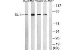 Western blot analysis of extracts from HuvEc/MCF-7/HepG2/HeLa cells, using Ezrin Antibody. (Ezrin Antikörper  (AA 511-560))