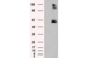 HEK293T cells were transfected with the pCMV6-ENTRY control (Left lane) or pCMV6-ENTRY LIPG (Right lane) cDNA for 48 hrs and lysed. (LIPG Antikörper)
