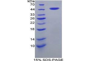 SDS-PAGE analysis of Human CRH Protein. (CRH Protein)