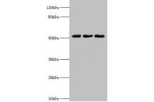 Western blot All lanes: BAG family molecular chaperone regulator 5 antibody at 2 μg/mL Lane 1: Mouse kidney tissue Lane 2: Mouse brain tissue Lane 3: Hela whole cell lysate Secondary Goat polyclonal to rabbit IgG at 1/10000 dilution Predicted band size: 52, 57 kDa Observed band size: 52 kDa (BAG5 Antikörper  (AA 1-447))