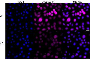 Immunocytochemical staining of HeLa cells using Caspase 9 antibody (ABIN7797912), 1:1,000), Top panel: wild-type (WT), Bottom panal: Caspase 9 shRNA knockdown (KD). (Rekombinanter Caspase 9 Antikörper)