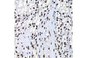 Immunohistochemistry (IHC) image for anti-H2A Histone Family, Member Y (H2AFY) (AA 123-372) antibody (ABIN6141569)