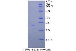 SDS-PAGE analysis of Mouse Protocadherin beta 2 Protein. (PCDHb2 Protein)