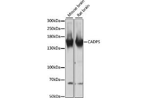 Western blot analysis of extracts of various cell lines, using CADPS antibody (ABIN6131298, ABIN6137843, ABIN6137844 and ABIN6217089) at 1:3000 dilution. (CADPS Antikörper  (AA 1020-1100))