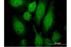 Immunofluorescence of monoclonal antibody to RAB3A on HeLa cell.