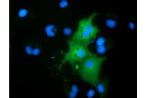 Anti-RBBP9 mouse monoclonal antibody (ABIN2453591) immunofluorescent staining of COS7 cells transiently transfected by pCMV6-ENTRY RBBP9 (RC202090). (RBBP9 Antikörper)