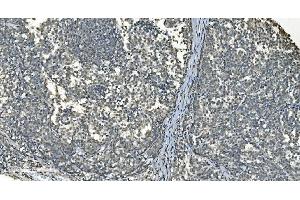 IHC analysis of LSM8 using anti-LSM8 antibody (ABIN7599579). (NAA38 Antikörper  (AA 1-96))
