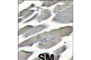 Formalin-fixed and paraffin-embedded skeletal muscle tissue reacted with PI3KCG antibody (Center) (ABIN392817 and ABIN2842248) , which was peroxidase-conjugated to the secondary antibody, followed by DAB staining.