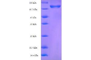 SDS-PAGE (SDS) image for Cysteine Sulfinic Acid Decarboxylase (CSAD) (AA 1-493), (full length) protein (His-SUMO Tag) (ABIN5709333) (CSAD Protein (AA 1-493, full length) (His-SUMO Tag))