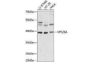 Western blot analysis of extracts of various cell lines, using VPS26A antibody  at 1:1000 dilution. (VPS26A Antikörper  (AA 208-327))