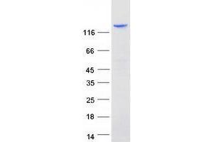 ZBTB10 Protein (Transcript Variant 1) (Myc-DYKDDDDK Tag)