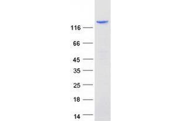 ZBTB10 Protein (Transcript Variant 1) (Myc-DYKDDDDK Tag)