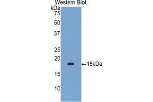 Western blot analysis of the recombinant protein. (Gastrokine 1 Antikörper  (AA 53-192))