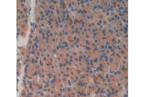 Used in DAB staining on fromalin fixed paraffin- embedded stomach tissue (XRN1 Antikörper  (AA 1567-1723))