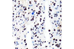 Immunohistochemistry (IHC) image for anti-Histone Deacetylase 2 (HDAC2) antibody (ABIN7267708)