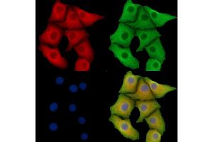ABIN7095798 and ABIN7099860 staining Hela cells by IF/ICC. (TMEM163 Antikörper)