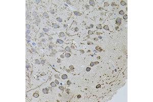 Immunohistochemistry of paraffin-embedded mouse brain using AR antibody (ABIN5971084) (40x lens). (Androgen Receptor Antikörper)