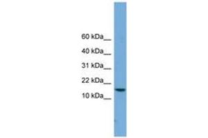 Image no. 1 for anti-P Antigen Family, Member 4 (Prostate Associated) (PAGE4) (C-Term) antibody (ABIN6744720) (PAGE4 Antikörper  (C-Term))