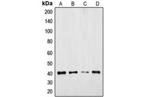 Western blot analysis of GPR175 expression in DLD (A), Jurkat (B), mouse colon (C), rat colon (D) whole cell lysates. (GPR175 Antikörper  (Center))