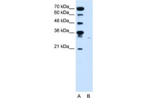 Western Blotting (WB) image for anti-Solute Carrier Family 22 (Organic Cation Transporter), Member 7 (SLC22A7) antibody (ABIN2462624) (SLC22A7 Antikörper)