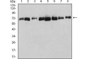 Western blot analysis using DDX5 mouse mAb against HT-29 (1), Hela (2), NIH/3T3 (3), COS7 (4), SW620 (5), Jurkat (6), A431 (7), and MCF-7 (8) cell lysate. (DDX5 Antikörper  (AA 475-614))