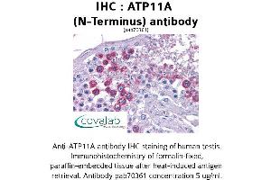 Image no. 1 for anti-ATPase, Class VI, Type 11A (ATP11A) (N-Term) antibody (ABIN1732072) (ATP11A Antikörper  (N-Term))