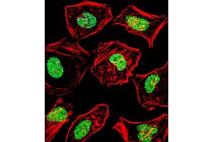 Fluorescent confocal image of Hela cell stained with HAND2 Antibody .