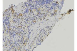 ABIN6278924 at 1/100 staining Human lymph node tissue by IHC-P. (Keratin 3 Antikörper  (C-Term))