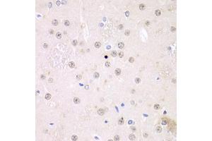 Immunohistochemistry of paraffin-embedded rat brain using FMRP Antibody (ABIN6127908, ABIN6140718, ABIN6140720 and ABIN6221284) at dilution of 1:100 (40x lens). (FMR1 Antikörper  (AA 1-290))