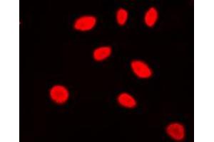 Immunofluorescent analysis of ZNF174 staining in Jurkat cells. (ZNF174 Antikörper  (Center))