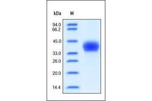 Human CD23, His Tag on SDS-PAGE under reducing (R) condition. (FCER2 Protein (AA 48-321) (His tag))