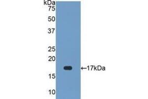Detection of Recombinant SOD1, Human using Polyclonal Antibody to Superoxide Dismutase 1 (SOD1) (SOD1 Antikörper  (AA 2-154))