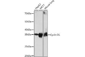 Western blot analysis of extracts of various cell lines, using Cyclin D1 antibody (ABIN7266561) at 1:1000 dilution.
