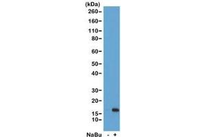 Western blot of acid extracts from HeLa cells untreated (-) or treated (+) with sodium butyrate using recombinant H3K36ac antibody at 1 ug/ml showed a band of Histone H3 acetylated at Lysine 36 in treated HeLa cells. (Rekombinanter Histone 3 Antikörper  (acLys36))