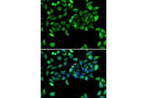 Immunofluorescence analysis of U2OS cells using EIF3H antibody. (EIF3H Antikörper)