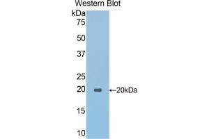 Detection of Recombinant SPTAN1, Mouse using Polyclonal Antibody to Alpha-Fodrin (SPTAN1) (SPTAN1 Antikörper  (AA 1049-1207))