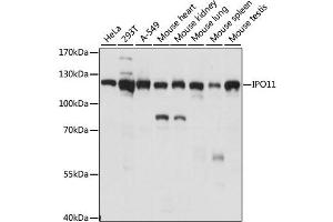 Western blot analysis of extracts of various cell lines, using IPO11 antibody. (Importin 11 Antikörper)