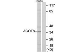 Western blot analysis of extracts from HuvEc cells, using ACOT8 Antibody. (ACOT8 Antikörper  (AA 131-180))