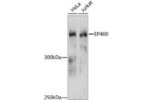 Western blot analysis of extracts of various cell lines, using EP400 antibody. (EP400 Antikörper)