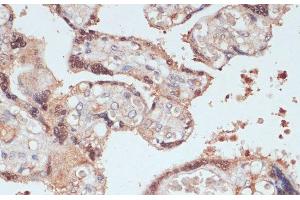 Immunohistochemistry of paraffin-embedded Human placenta using MYCBP Polyclonal Antibody at dilution of 1:100 (40x lens). (MYCBP Antikörper)