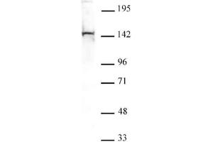 PGC1-β antibody tested by Western blot. (PPARGC1B Antikörper  (N-Term))