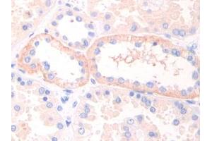 IHC-P analysis of Human Kidney Tissue, with DAB staining. (LIFR Antikörper  (AA 692-833))