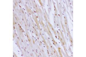 Anti- NR3C1 antibody,IHC(P) IHC(P): Rat Cardiac Muscle Tissue (Glucocorticoid Receptor Antikörper  (AA 1-373))