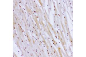 Anti- NR3C1 antibody,IHC(P) IHC(P): Rat Cardiac Muscle Tissue