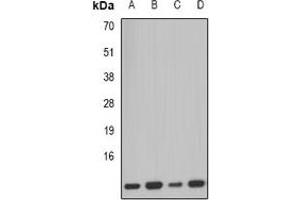 Western blot analysis of PCBD1 expression in SW620 (A), mouse kidney (B), mouse pancreas (C), rat liver (D) whole cell lysates.