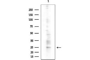 Western blot analysis of lysates from COLO205 cells(heat-shock treatment), using RHOD Antibody at 1/1000 dilution.