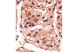 Image no. 1 for anti-Presenilin 1 (PSEN1) (C-Term) antibody (ABIN358721) (Presenilin 1 Antikörper  (C-Term))