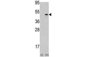 Western blot analysis of Aurora B antibody and 293 cell lysate (2 ug/lane) either nontransfected (Lane 1) or transiently transfected with the AURKB gene (2).
