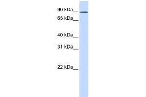 WB Suggested Anti-C2orf3 Antibody Titration: 0. (GCFC2 Antikörper  (N-Term))