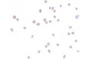 Immunohistochemistry (IHC) image for anti-Zinc Finger E-Box Binding Homeobox 2 (ZEB2) (C-Term) antibody (ABIN1030819) (ZEB2 Antikörper  (C-Term))